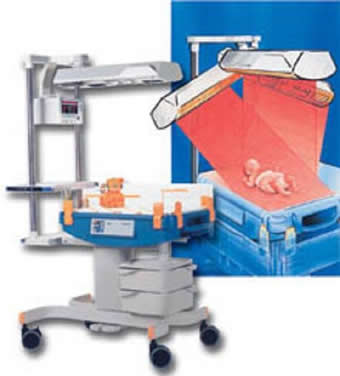 neonatal ventilation